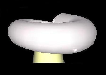 Tubula